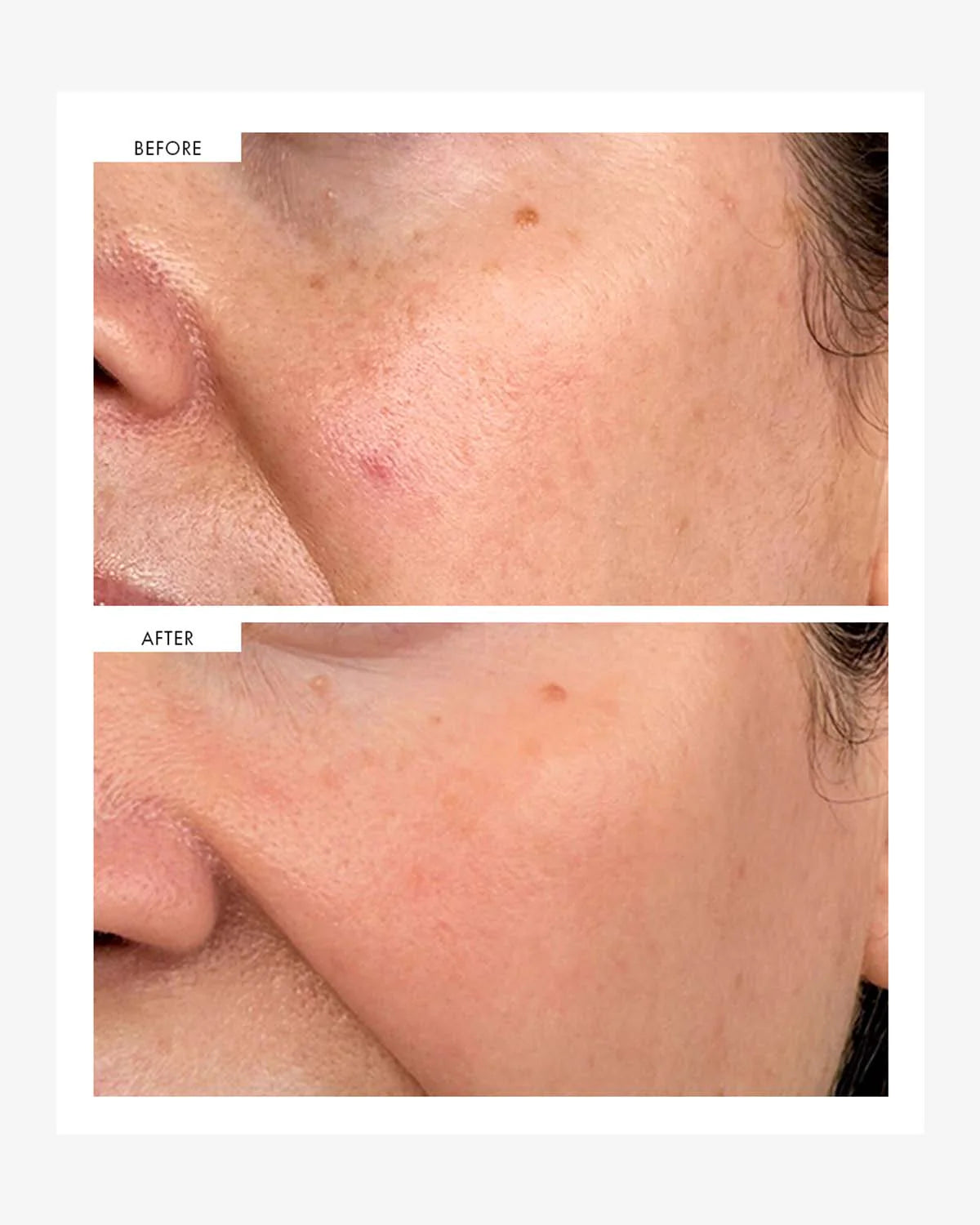 111SKIN Dark Spot Correcting Serum 美白淡斑精華 30ml